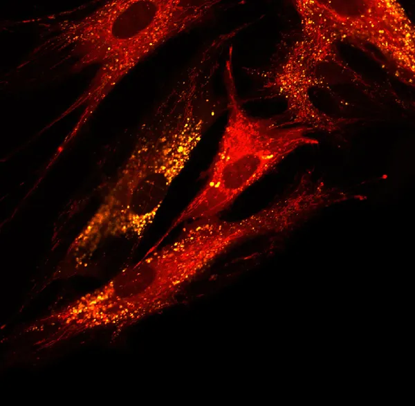 Fibroblasty (kožní buňky) označen fluorescenční — Stock fotografie