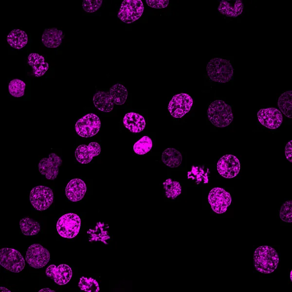 Cellules sanguines marquées avec des colorants fluorescents — Photo