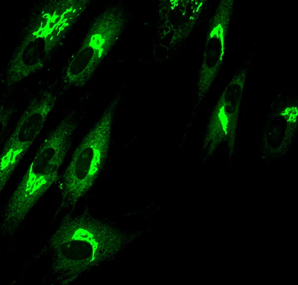 Fibroblasty (komórki skóry) oznaczane są Farby luminescencyjne, fluoroscencyjne — Zdjęcie stockowe