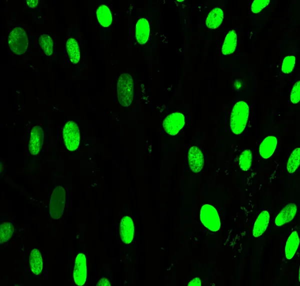 Jądro fibroblastów oznaczony zielonym barwnikiem fluorescencyjnym — Zdjęcie stockowe