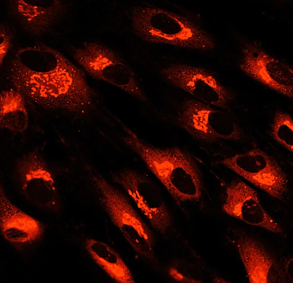 Fibroblastes (cellules de la peau) marqués avec des colorants fluorescents — Photo