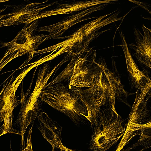 Fibroblasts (skin  cells) labeled with fluorescent dyes — Stock Photo, Image