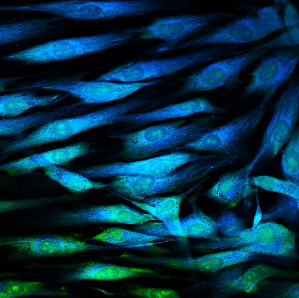 Fibroblasts (skin  cells) labeled with fluorescent dyes — Stock Photo, Image