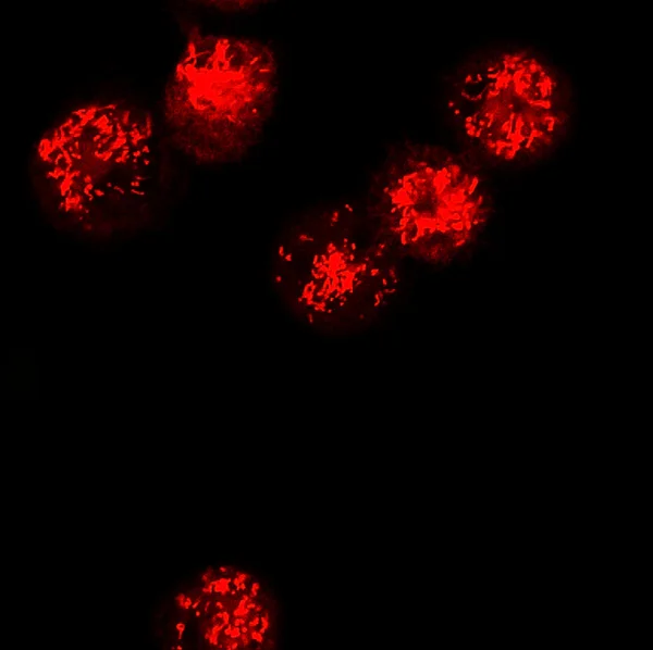 Dendritic cells labeled with fluorescent dyes — Stock Photo, Image