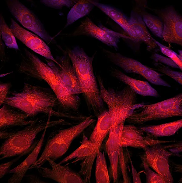 Fibroblaster (hudceller) märkt med fluorescerande färger — Stockfoto