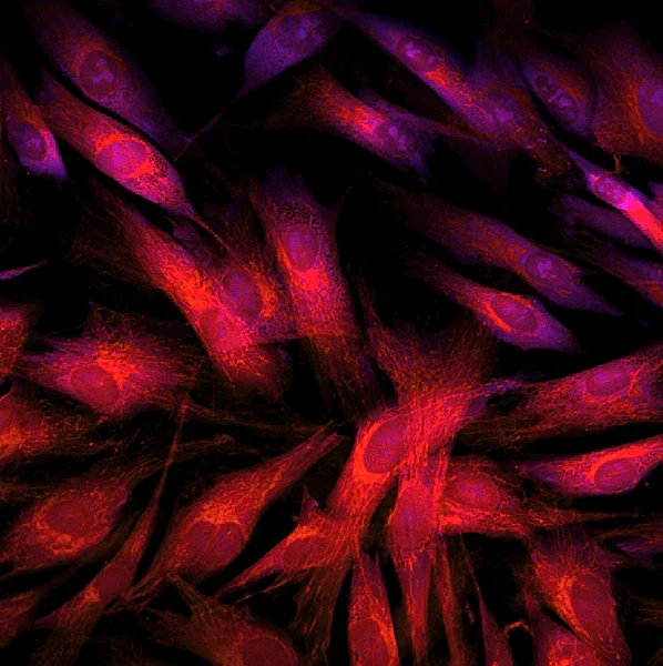 fibroblastlar (deri hücreleri) floresan boyalar ile Etiketlenmiş