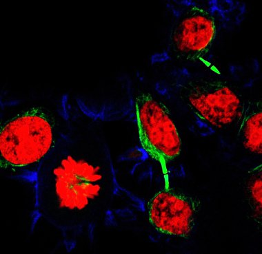 epitelyal tümör hücreleri floresan molekülleri ile Etiketlenmiş