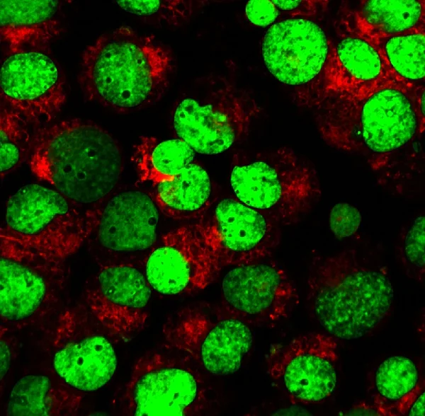 Blutkörperchen mit fluoreszierenden Farbstoffen markiert — Stockfoto