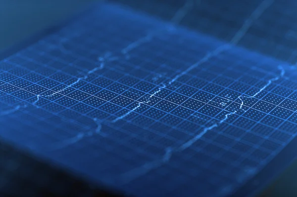 EKG-Elektrokardiogramm — Stockfoto