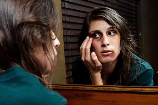 Extent of injuries domestic abuse concept — Stock Photo, Image