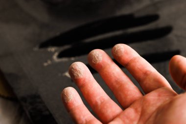 caucasian hand with dust on finger tips after touching black dusty surface, closeup with selective focus