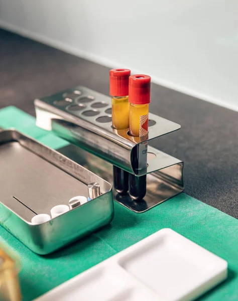 Prf Bloedplaatjes Rijke Fibrine Therapie Bloedbuis Gel Voor Tandheelkundige Behandeling — Stockfoto