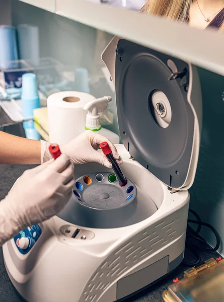 Krankenschwester Legte Blutprobe Laborzentrifuge Zur Trennung Von Flüssigkeiten — Stockfoto