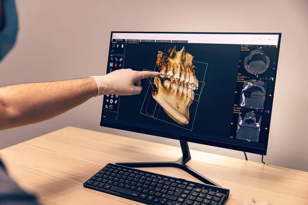 在牙科诊所 戴手套的医生在数字屏幕上显示牙齿X光片 健康牙齿概念 — 图库照片