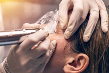 Plazma göz kaldırma, ileri yaşlanma önleyici tedavi, genellikle cerrahi olmayan göz kapağı kaldırma ya da invazif olmayan blePharoplasty olarak bilinir.