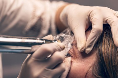 Plazma göz kaldırma, ileri yaşlanma önleyici tedavi, genellikle cerrahi olmayan göz kapağı kaldırma ya da invazif olmayan blePharoplasty olarak bilinir.