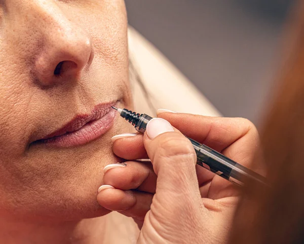 Cosmetician Drawing Lines Mouth Woman Inject Hyaluronic Acid — Stock fotografie