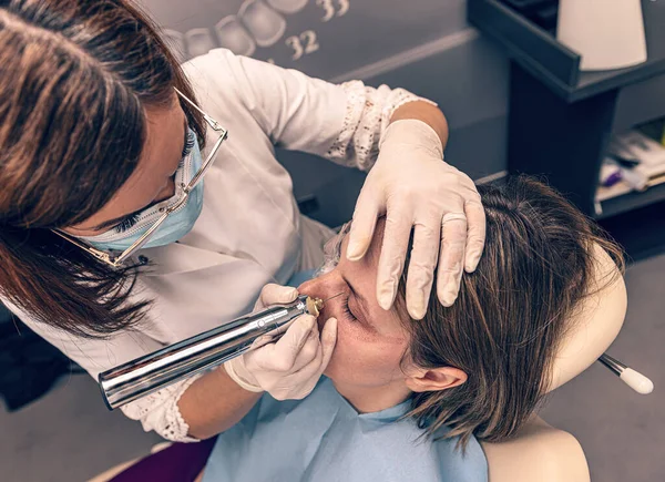 Procedimientos Cosméticos Quirúrgicos Para Los Ojos Mediante Técnica Fibroblastos Plasmáticos —  Fotos de Stock