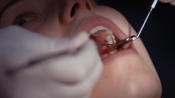 Пациент Кабинете Дантиста Закрыть Обширное Обследование Зубов — стоковое видео