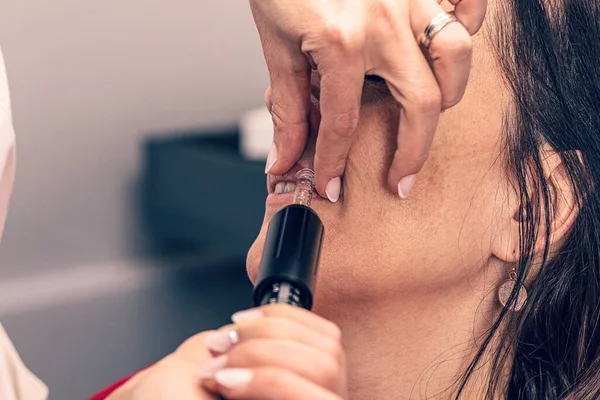 Cosmetólogo Realiza Microinyecciones Con Pluma Hialurón — Foto de Stock