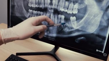 Klinikteki bilgisayarda çene röntgenini inceleyen erkek dişçi