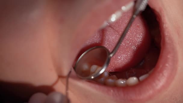 Närbild Ung Flicka Att Tandläkarundersökning Och Använda Tandspegel — Stockvideo