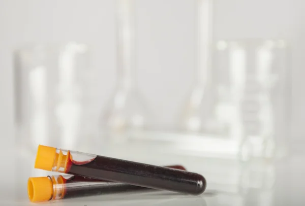 Test tubes with blood sample — Stock Photo, Image