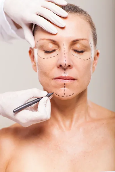 Senior woman preparing for plastic surgery — Stock Photo, Image