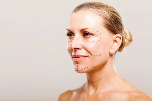 Woman getting ready for plastic surgery — Stock Photo, Image