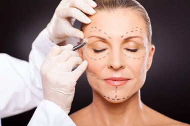 middle aged woman preparing for plastic surgery clipart