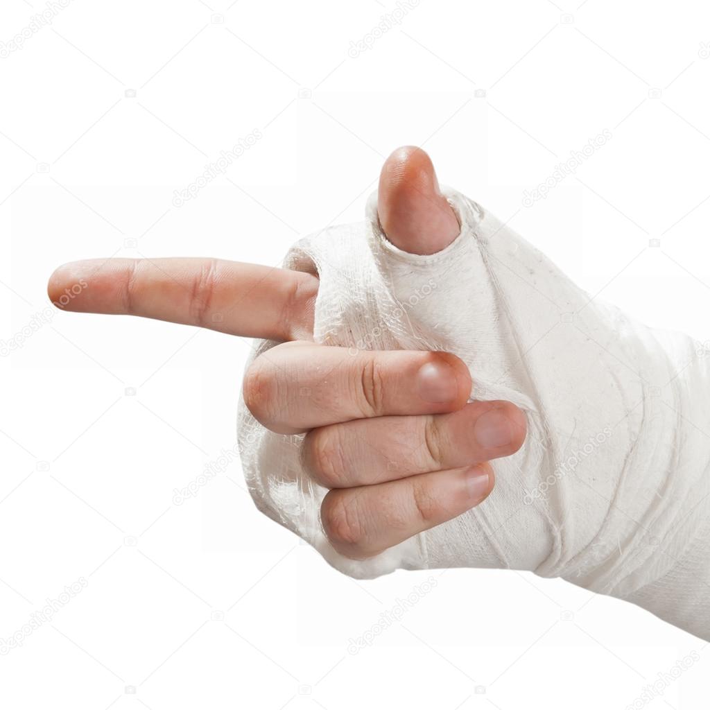 Broken arm in a cast. Finger pointing aside