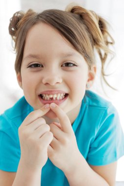 Çocuk bir dişini kaybetti. Dişsiz bebek. Dişi olmayan küçük bir kızın portresi..