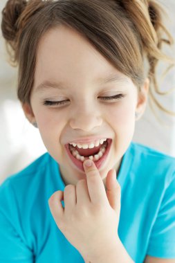 Çocuk bir dişini kaybetti. Dişsiz bebek. Dişi olmayan küçük bir kızın portresi..