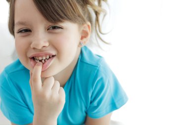 The child has lost a tooth. Little girl without a tooth. The first tooth fell out. High quality photo