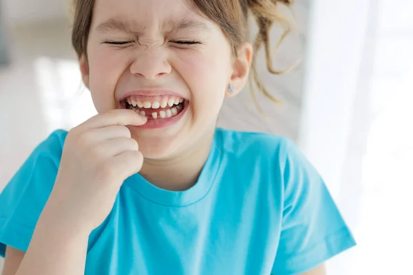 Child Has Lost Tooth Little Girl Tooth First Tooth Fell — Φωτογραφία Αρχείου