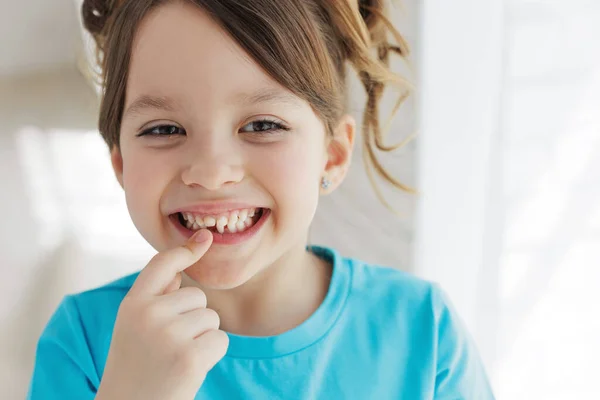 Child Has Lost Tooth Little Girl Tooth First Tooth Fell — Φωτογραφία Αρχείου