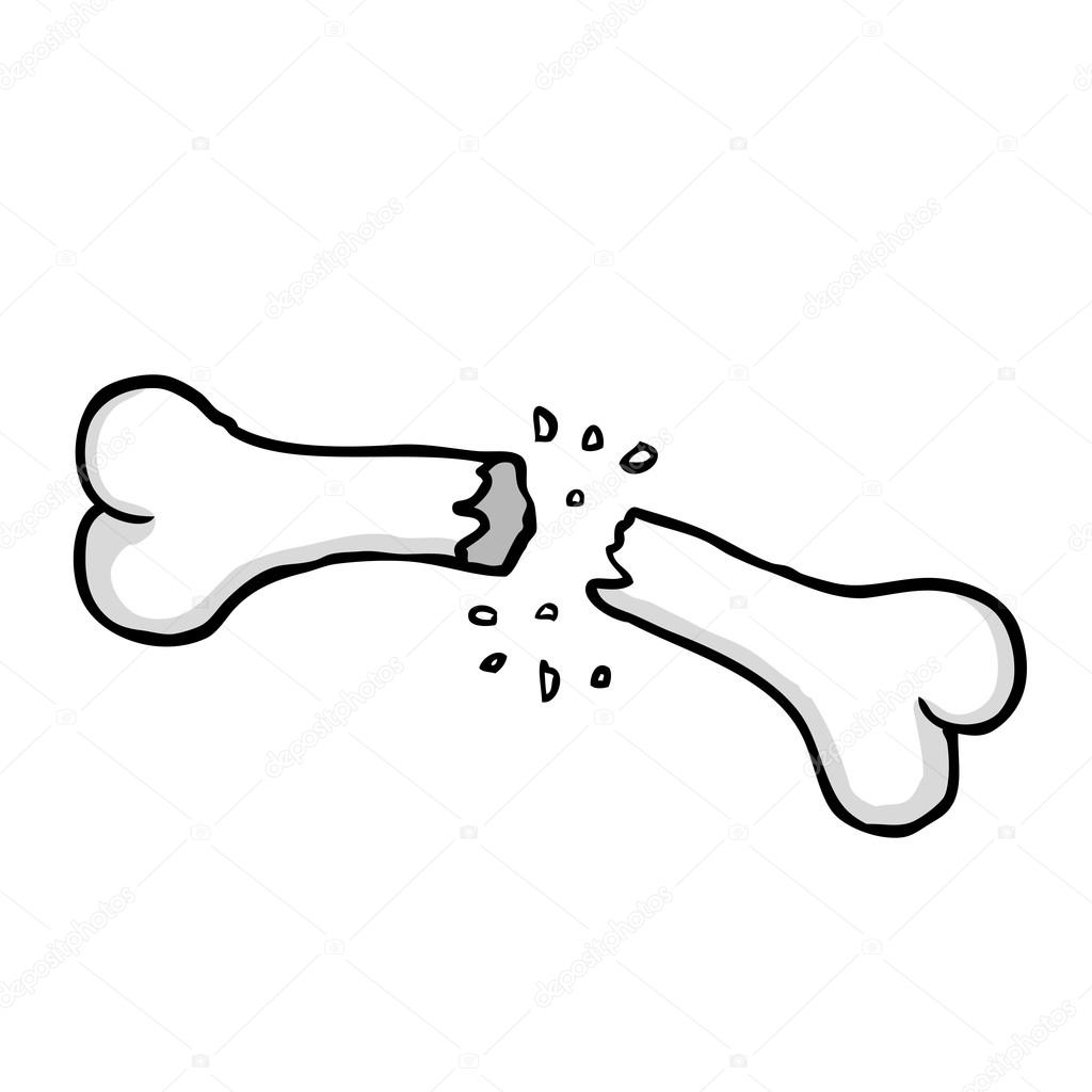 Broken bone Stock Vector Image by ©SynchR #19287169 Broken bone Stock Vector Image by ©SynchR #19287169