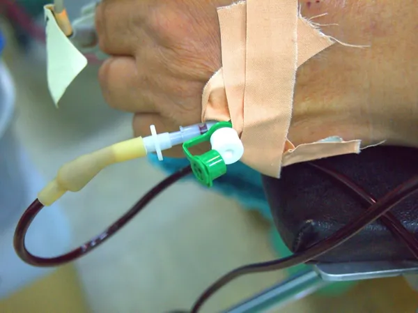 Hand med transfusion — Stockfoto