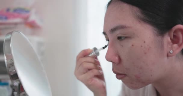 亚洲妇女化妆品和保健的概念 一位皮肤问题的少女正在使用治疗霜 皮肤护理的概念 痤疮是一种皮肤病 — 图库视频影像