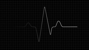 Heartbeat display animation 4k on motion graphics. Healtcare, medical or gym concept. 4k infinite loopable animation sequence.