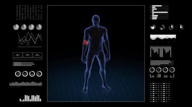 Dirsek patolojisi olan adam. Çocuğun üç boyutlu vücudu. Dönen animasyon ve erkek insan yapısına yakın çekim. 4k HUD görüntüsü.