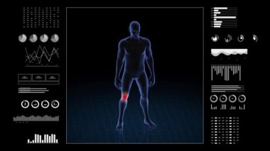 Diz patolojisi olan adam. Çocuğun üç boyutlu vücudu. Dönen animasyon ve erkek insan yapısına yakın çekim. 4k HUD görüntüsü.