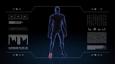 Ayak patolojisi olan bir adam. Çocuğun üç boyutlu vücudu. Dönen animasyon ve erkek insan yapısına yakın çekim. 4k HUD görüntüsü.
