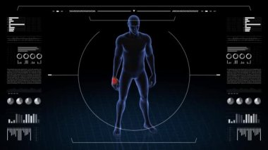 El patolojisi olan bir adam. Çocuğun üç boyutlu vücudu. Dönen animasyon ve erkek insan yapısına yakın çekim. 4k HUD görüntüsü.