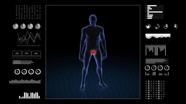 Homem Com Patologia Genital Corpo Menino Animação Rotativa Close Estrutura — Vídeo de Stock