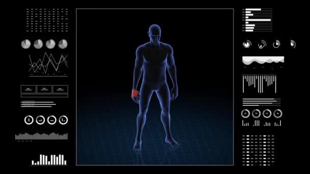 Man Hand Pathology Body Boy Rotating Animation Closeup Male Human — Stock Video