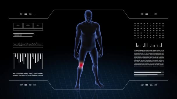 Hombre Con Patología Rodilla Cuerpo Niño Animación Rotatoria Primer Plano — Vídeos de Stock