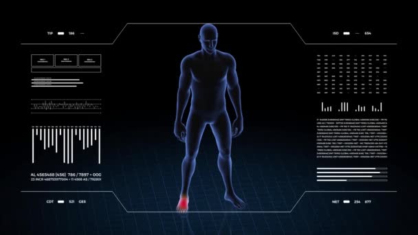 有足部病理学的人3D身体的男孩 旋转动画和男性人体结构的特写 Hud镜头 — 图库视频影像