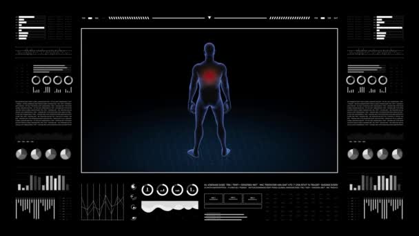 Man Back Pathology Body Boy Rotating Animation Closeup Male Human — Stock Video