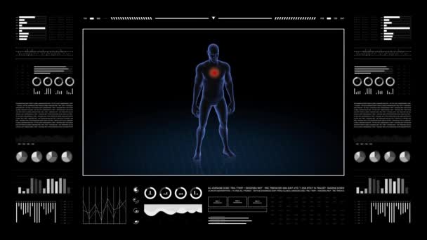 Man Chest Pathology Body Boy Rotating Animation Closeup Male Human — Stock Video